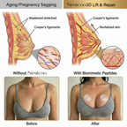 Targeted Bust Care Microneedle Patches – Firm-Looking Skin & Shape Support