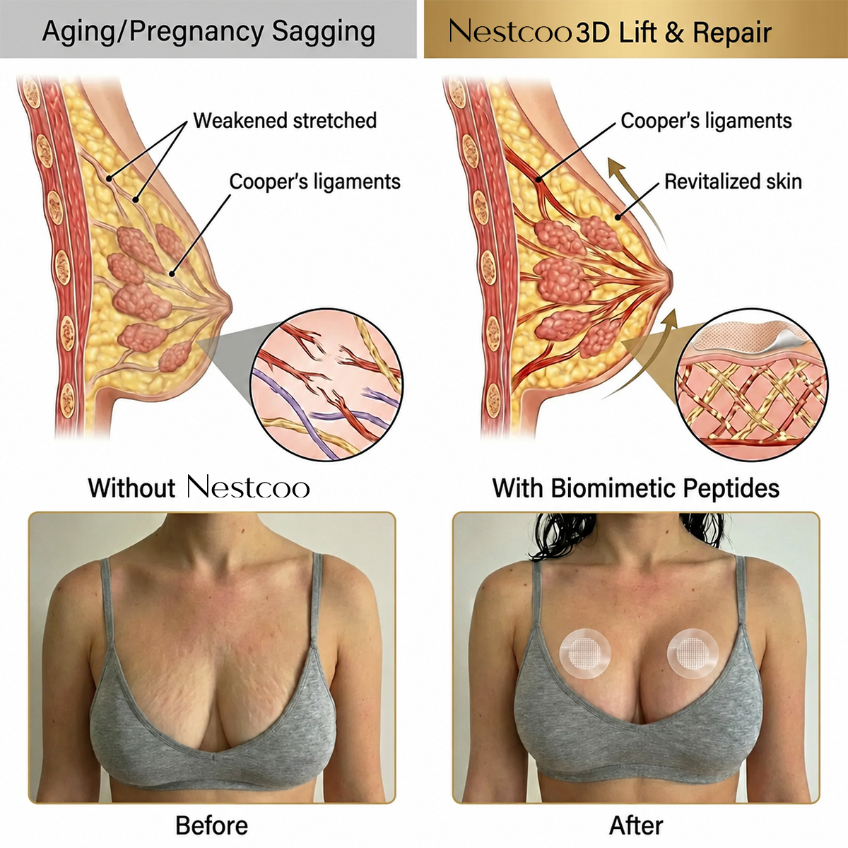 Targeted Bust Care Microneedle Patches – Firm-Looking Skin & Shape Support
