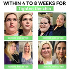 🔥Transdermal slimming patch – once a day, results in 7 days